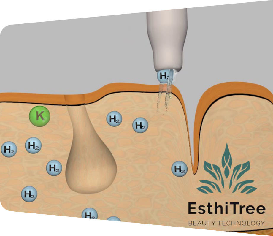 aktive H2-Moleküle und zelluläre Reinigung